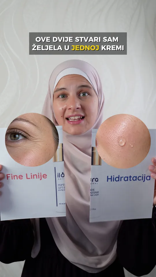 Belma objašnjava njegu finih linija i hidrataciju